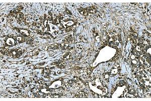 IHC analysis of RAB13 using anti-RAB13 antibody (ABIN7600599).