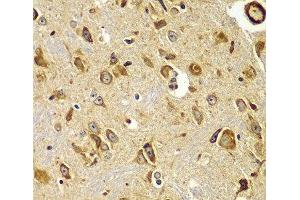 Immunohistochemistry of paraffin-embedded Mouse brain using SMAD9 Polyclonal Antibody at dilution of 1:100 (40x lens). (SMAD9 antibody)