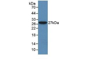 Detection of Recombinant ALT, Rat using Monoclonal Antibody to Alanine Aminotransferase (ALT) (ALT antibody  (AA 203-443))