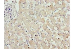 Immunohistochemistry of paraffin-embedded human liver tissue using ABIN7176493 at dilution of 1:100 (ZNF643 antibody  (AA 15-310))