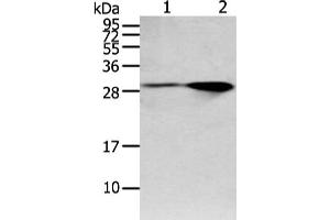 Gel: 12 % SDS-PAGE, Lysate: 40 μg, Lane 1-2: Mouse brain and human fetal brain tissue, Primary antibody: ABIN7128020(SPIN4 Antibody) at dilution 1/200 dilution, Secondary antibody: Goat anti rabbit IgG at 1/8000 dilution, Exposure time: 1 minute (SPIN4 antibody)