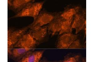 Immunofluorescence analysis of C6 cells using IPO4 Polyclonal Antibody at dilution of 1:100. (Importin 4 antibody)