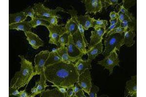 Immunofluorescence (IF) image for Goat anti-Mouse IgG antibody (Alexa Fluor 555) (ABIN2667000) (Goat anti-Mouse IgG Antibody (Alexa Fluor 555))