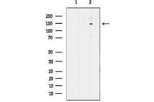 Western blot analysis of lysates from HepG2 cells, using DHX38 Antibody.