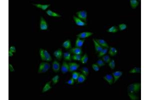 Immunofluorescence staining of Hela cells with ABIN7161665 at 1:200, counter-stained with DAPI. (OPRL1 antibody  (AA 323-370))
