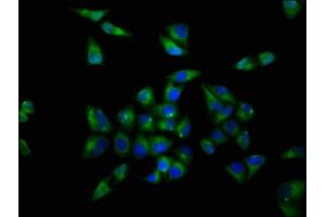 Immunofluorescence staining of Hela cells with ABIN7161665 at 1:200, counter-stained with DAPI.