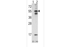 Western blot analysis of CAMK2A using rabbit polyclonal C using 293 cell lysates (2 ug/lane) either nontransfected (Lane 1) or transiently transfected with the CAMK2A gene (Lane 2). (CAMK2A antibody  (C-Term))