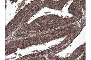 Image no. 2 for anti-Cancer/testis Antigen 1B (CTAG1B) antibody (ABIN1499906) (CTAG1B antibody)