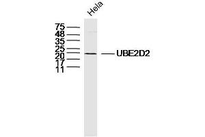 Hela lysates probed with UBE2D2 Polyclonal Antibody, Unconjugated  at 1:300 dilution and 4˚C overnight incubation. (UBE2D2 antibody  (AA 31-130))
