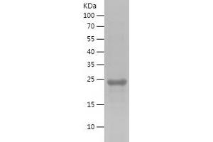 Western Blotting (WB) image for Spermatogenesis Associated 22 (SPATA22) (AA 1-200) protein (His tag) (ABIN7282974) (SPATA22 Protein (AA 1-200) (His tag))