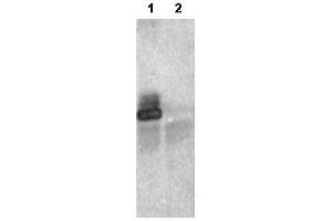 1 µg of ’s affinity purified anti-RNF25 was used in immunoprecipitation of 20 µg HEK293 cell lysate over-expressing HA-tagged human RNF25 (lane 1) or vector only control (lane 2). (RNF25 antibody  (C-Term))