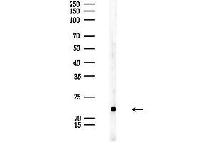 Western blot analysis of lysates from Rat testis, using  Antibody at 1/1000 dilution.