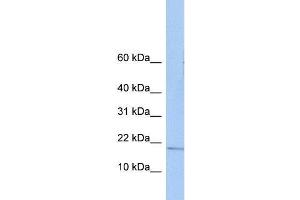 Human Placenta; WB Suggested Anti-ZNHIT3 Antibody Titration: 0. (ZNHIT3 antibody  (N-Term))