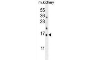 Western Blotting (WB) image for anti-Harakiri, BCL2 Interacting Protein (Contains Only BH3 Domain) (HRK) (BH3 Domain) antibody (ABIN2997154) (HRK antibody  (BH3 Domain))