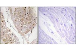 Immunohistochemistry analysis of paraffin-embedded human heart tissue, using LEG2 Antibody. (LEG2 antibody  (AA 31-80))