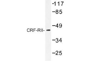 Image no. 1 for anti-Corticotropin Releasing Hormone Receptor 2 (CRHR2) antibody (ABIN317648) (CRHR2 antibody)