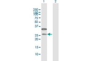 Western Blot analysis of CD79B expression in transfected 293T cell line by CD79B MaxPab polyclonal antibody. (CD79b antibody  (AA 1-229))