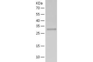 Western Blotting (WB) image for Small Glutamine-Rich Tetratricopeptide Repeat (TPR)-Containing, alpha (SGTA) (AA 1-313) protein (His tag) (ABIN7125127) (SGTA Protein (AA 1-313) (His tag))