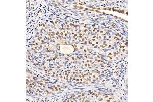 Immunohistochemistry of paraffin-embedded rat spleen using TES Rabbit pAb (ABIN7270772) at dilution of 1:200 (40x lens). (TES antibody  (AA 1-260))