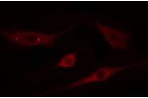 ABIN6274811 staining NIH-3T3 cells by IF/ICC. (ADAMTS18 antibody  (C-Term))