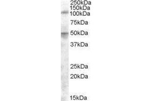 Western Blotting (WB) image for Endoplasmic Reticulum Aminopeptidase 2 (ERAP2) peptide (ABIN369732) (Endoplasmic Reticulum Aminopeptidase 2 (ERAP2) Peptide)