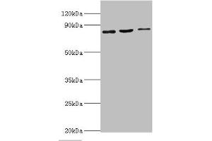 Western blot All lanes: SATB1 antibody at 2 μg/mL Lane 1: Mouse brain tissue Lane 2: 293T whole cell lysate Lane 3: Jurkat whole cell lysate Secondary Goat polyclonal to rabbit IgG at 1/10000 dilution Predicted band size: 86, 90 kDa Observed band size: 86 kDa (SATB1 antibody  (AA 484-763))