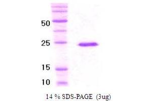 Von Hippel-Lindau Tumor Suppressor, E3 Ubiquitin Protein Ligase (VHL) (AA 1-154) protein (His tag)