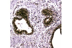 IHC analysis of SAE2/UBA2 using anti-SAE2/UBA2 antibody .