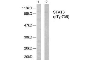Western blot analysis of extracts from HeLa cells using STAT3 (phospho-Tyr705) antibody (E011045). (STAT3 antibody  (pTyr705))