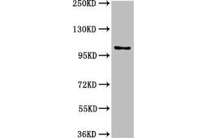 Western Blot Positive WB detected in: U87 whole cell lysate All lanes: AMPD2 antibody at 3 μg/mL Secondary Goat polyclonal to rabbit IgG at 1/50000 dilution Predicted band size: 101, 93, 89 kDa Observed band size: 101 kDa (AMPD2 antibody  (AA 1-129))