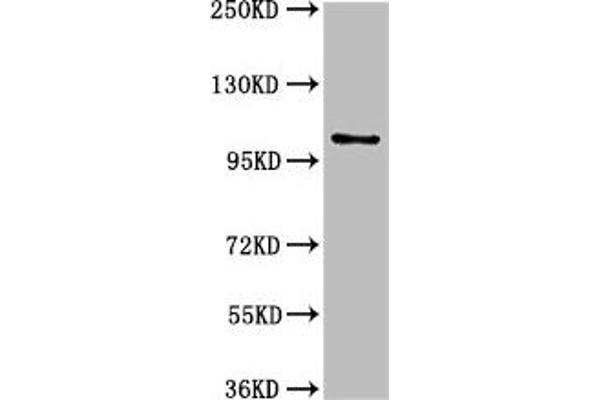 AMPD2 Antikörper  (AA 1-129)
