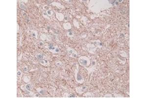 DAB staining on IHC-P; Samples:Human Brain Tissue) (PAI1 antibody  (AA 25-402))