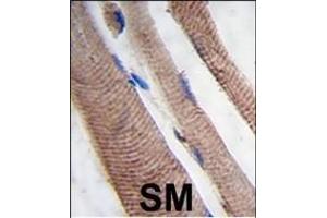 Immunohistochemistry (Paraffin-embedded Sections) (IHC (p)) image for anti-Phosphoinositide-3-Kinase, Class 3 (PIK3C3) (AA 14-39) antibody (ABIN388594)