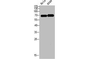 Western blot analysis of HELA A549 Cell Lysate, antibody was diluted at 1:1000. (DCT antibody  (AA 1268-1341))