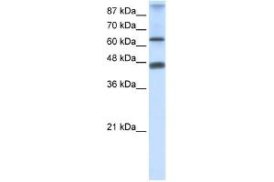 WB Suggested Anti-ZNF79 Antibody Titration:  0. (ZNF79 antibody  (N-Term))