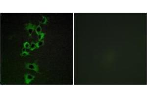 Immunofluorescence analysis of HepG2 cells, using HER4 (Ab-1284) Antibody.