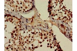 Immunohistochemistry of paraffin-embedded human testis tissue using ABIN7164998 at dilution of 1:100 (POT1 antibody  (AA 250-432))