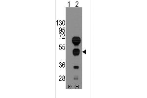 Western blot analysis of GATA4 using rabbit polyclonal GATA4 Antibody using 293 cell lysates (2 ug/lane) either nontransfected (Lane 1) or transiently transfected with the GATA4 gene (Lane 2). (GATA4 antibody  (C-Term))