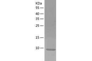 Western Blotting (WB) image for Organic Solute Transporter beta (OSTBETA) (AA 57-128) protein (His-IF2DI Tag) (ABIN7124269)