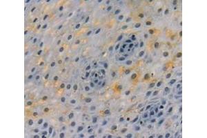 Immunohistochemistry (IHC) image for anti-Nuclear Factor of kappa Light Polypeptide Gene Enhancer in B-Cells 2 (NFKB2) (AA 25-224) antibody (ABIN7434146)