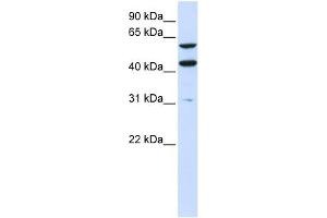 PTDSS1 antibody used at 1 ug/ml to detect target protein. (PTDSS1 antibody  (N-Term))