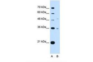 Image no. 2 for anti-Uronyl-2-Sulfotransferase (UST) (AA 301-350) antibody (ABIN321131) (UST antibody  (AA 301-350))
