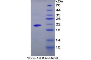 SDS-PAGE analysis of Human MGA Protein. (AGLU Protein)