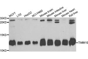 Western blot analysis of extracts of various cells, using TIMM10 antibody. (TIMM10 antibody)