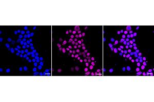 Immunocytochemical staining of HeLa cells with ISL1 antibody (ABIN7799130), 1:1,000).