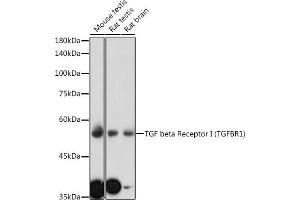 Western blot analysis of extracts of various cell lines, using TGF beta Receptor I (TGF beta Receptor I (TGFBR1)) antibody (ABIN6130733, ABIN6149081, ABIN6149082 and ABIN6213963) at 1:1000 dilution.