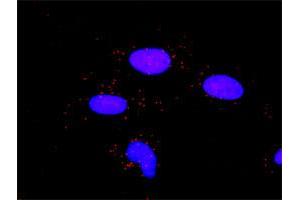 Proximity Ligation Analysis of protein-protein interactions between MMP2 and A2M. (MMP2 antibody  (AA 1-660))