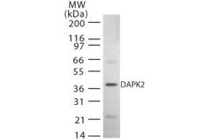 Western Blotting (WB) image for anti-Death-Associated Protein Kinase 2 (DAPK2) (AA 325-342) antibody (ABIN208411)