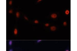 Immunofluorescence analysis of NIH/3T3 cells using p21 Polyclonal Antibody at dilution of 1:100. (p21 antibody)