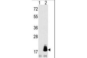 Western blot analysis of EIF4EBP1 (arrow) using rabbit polyclonal EIF4EBP1 Antibody (T69) (R). (eIF4EBP1 antibody  (AA 48-77))